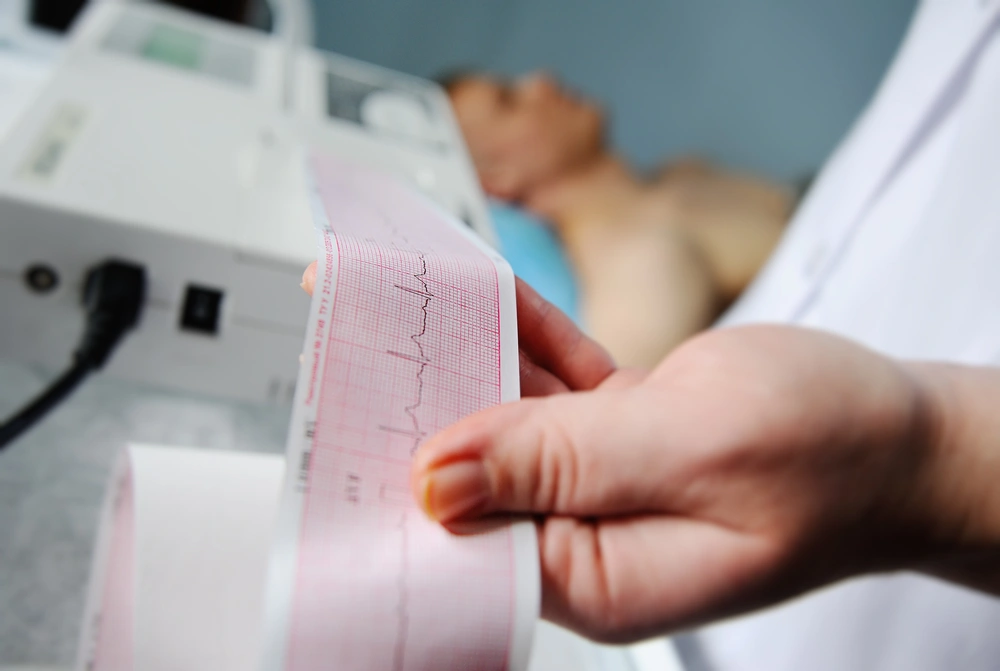 Medisan Sağlık Sistemleri | EKG Cihazı Fiyatları Ne Kadar?